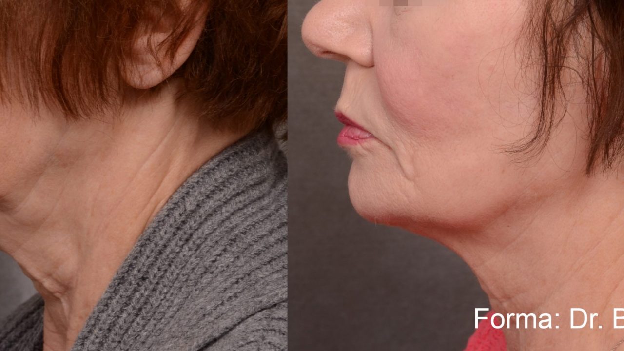 forma before after dr b ridenour preview 1